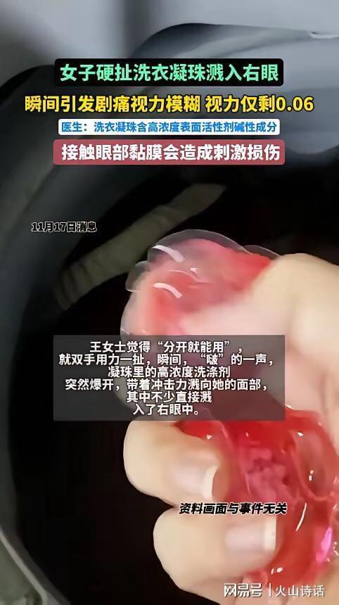杭州一女子撕扯凝珠发生意外致眼睛失明新葡京网上赌场恐怖！洗衣引发“爆炸”(图1)